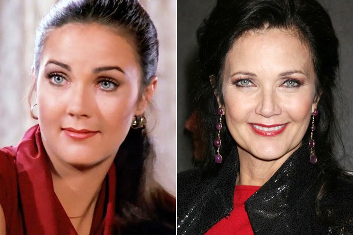 Celebrities Who Have Gotten Better-Looking With Age: Who Stayed Natural ...